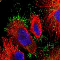 Myotubularin Antibody, Novus Biologicals:Antibodies:Primary Antibodies